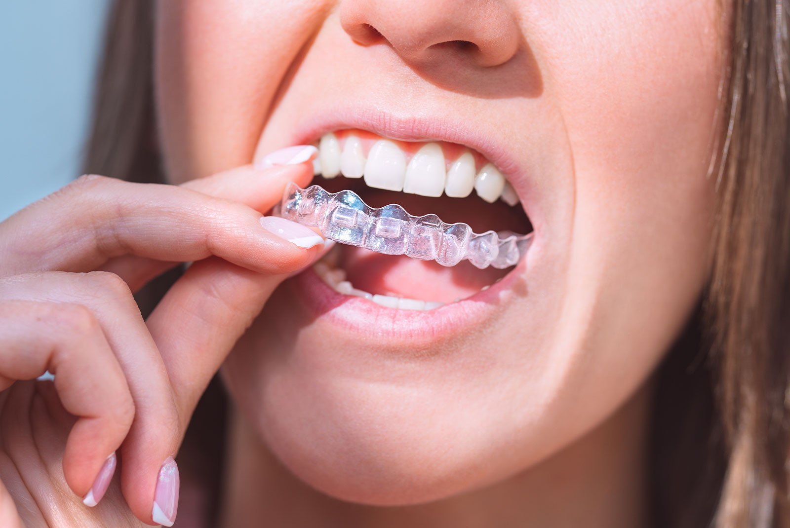 person putting in a invisalign